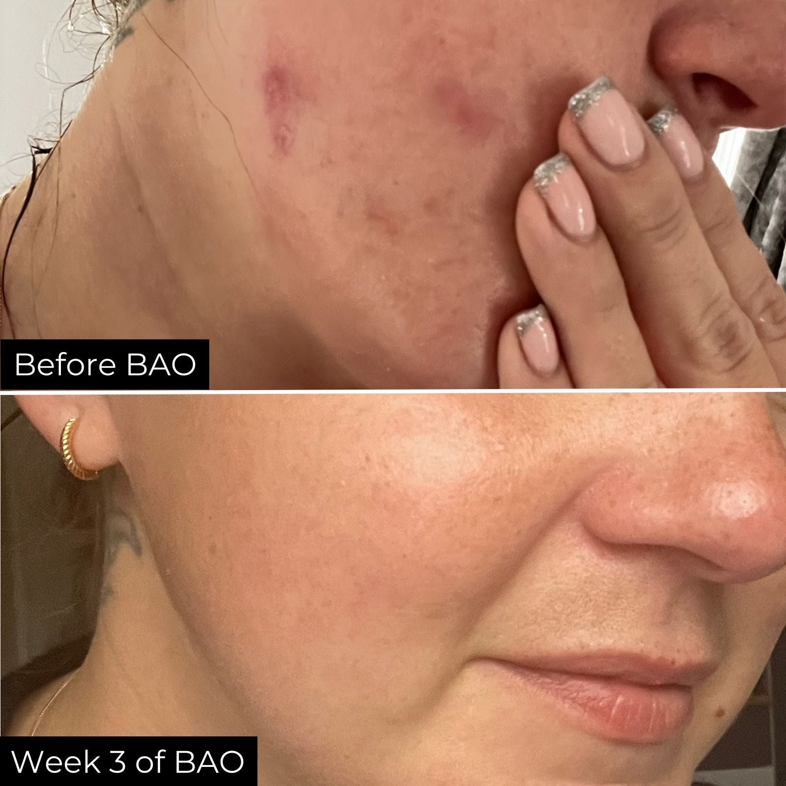 Before and after comparison of a customer&