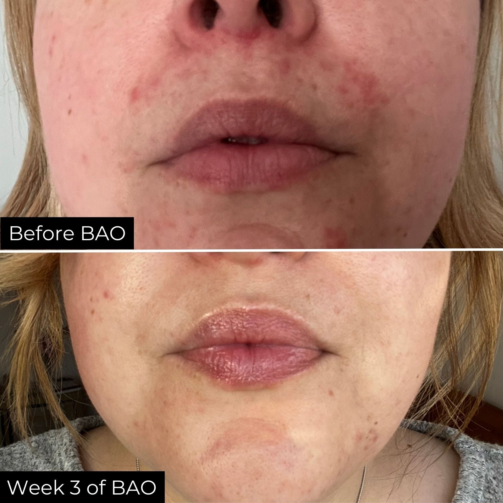 Before and after comparison of a customer&