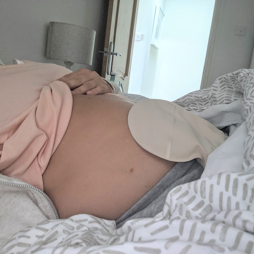 Beth's journey with Crohn's Disease & Stoma